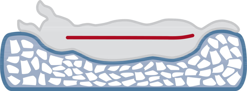 orthopedic dog bed