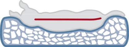 orthopedic dog bed